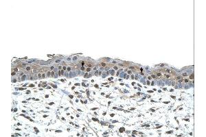 CENPA antibody was used for immunohistochemistry at a concentration of 4-8 ug/ml.