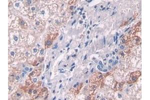Detection of ATP6AP2 in Human Liver Tissue using Polyclonal Antibody to ATPase, H+ Transporting, Lysosomal Accessory Protein 2 (ATP6AP2)