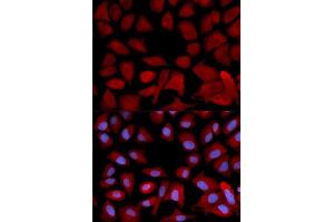 Immunofluorescence analysis of U2OS cells using PSMC4 antibody. (PSMC4 anticorps  (AA 1-165))