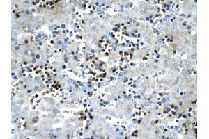 SCD antibody was used for immunohistochemistry at a concentration of 4-8 ug/ml to stain Hepatocytes (arrows) in Human liver. (SCD anticorps)