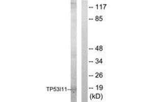 Western blot analysis of extracts from HuvEc cells, using TP53I11 Antibody. (TP53I11 anticorps  (AA 71-120))
