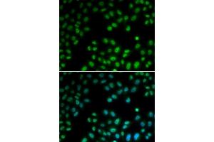 Immunofluorescence analysis of U2OS cells using PI antibody (ABIN6128449, ABIN6145593, ABIN6145595 and ABIN6221396).