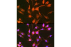 Immunofluorescence analysis of NIH-3T3 cells using PSMD14 Rabbit mAb (ABIN7269588) at dilution of 1:100 (40x lens).