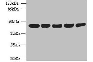 Western blot All lanes: ACTRT3 antibody at 2. (ARPM1 anticorps  (AA 1-372))