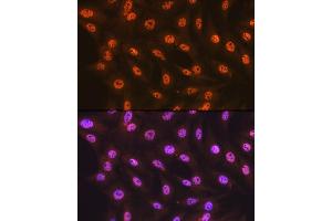 Immunofluorescence analysis of C6 cells using SF3B1 Rabbit mAb (ABIN7270542) at dilution of 1:100 (40x lens).