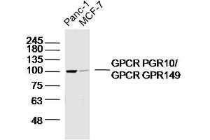 Lane 1: panc-1 lysates Lane 2: MCF-7 lysates probed with GPCR PGR10/GPCR GPR149 Polyclonal Antibody, Unconjugated  at 1:300 dilution and 4˚C overnight incubation. (GPR149 anticorps  (AA 1-100))