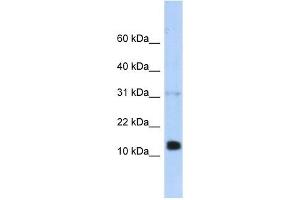 REG1B antibody used at 1 ug/ml to detect target protein.