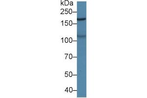 Detection of MAST2 in Porcine Cerebrum lysate using Polyclonal Antibody to Microtubule Associated Serine/Threonine Kinase 2 (MAST2) (MAST2 anticorps  (AA 512-785))