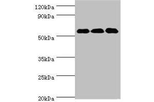 Western blot All lanes: XIAP antibody at 3 μg/mL Lane 1: HepG2 whole cell lysate Lane 2: MCF-7 whole cell lysate Lane 3: PC-3 whole cell lysate Secondary Goat polyclonal to rabbit IgG at 1/10000 dilution Predicted band size: 57 kDa Observed band size: 57 kDa (XIAP anticorps  (AA 1-200))