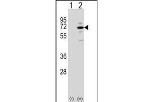 Western blot analysis of MeCP2 (arrow) using rabbit polyclonal MeCP2 Antibody (E11) (ABIN650708 and ABIN2839305). (MECP2 anticorps  (N-Term))