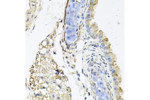 Immunohistochemistry of paraffin-embedded mouse lung using CTSK antibody (ABIN5970899) at dilution of 1/100 (40x lens). (Cathepsin K anticorps)