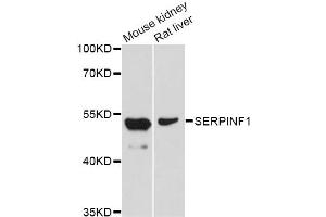 Western blot analysis of extracts of various cell lines, using SERPINF1 Antibody (ABIN5998782) at 1/1000 dilution. (PEDF anticorps)