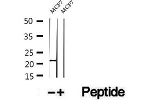 Western blot analysis of extracts of MCF7 cells, using PTP4A1/PRL1 antibody. (PTP4A1 anticorps  (C-Term))