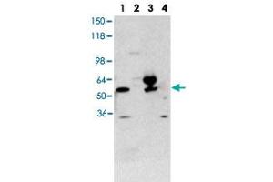 Western blot using THRA polyclonal antibody  shows detection of purified recombinant THRA (lane 1) and THRA present in a 293 cell lysate after transient transfection with THRA (lane 3). (THRA anticorps  (N-Term))