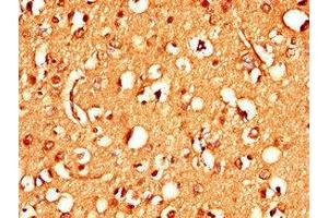 Immunohistochemistry of paraffin-embedded human brain tissue using ABIN7170837 at dilution of 1:100