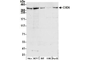 anti-Chromodomain Helicase DNA Binding Protein 6 (CHD6) (AA 2665-2715) antibody