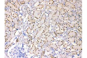 IHC analysis of ADK using anti- ADK antibody .