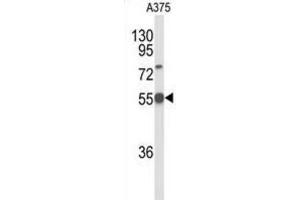 Western Blotting (WB) image for anti-delta Like Protein 3 (DLL3) antibody (ABIN5024655) (DLL3 anticorps)