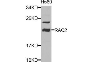 Western blot analysis of extracts of HL-60 cells, using RAC2 antibody (ABIN5970487) at 1/1000 dilution. (RAC2 anticorps)