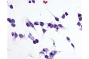 Immunocytochemistry (ICC) image for anti-Purinergic Receptor P2Y, G-Protein Coupled, 1 (P2RY1) (C-Term) antibody (ABIN1049199) (P2RY1 anticorps  (C-Term))