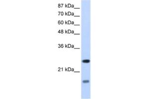 Western Blotting (WB) image for anti-Signal Recognition Particle 14kDa (Homologous Alu RNA Binding Protein) (SRP14) antibody (ABIN2462140)