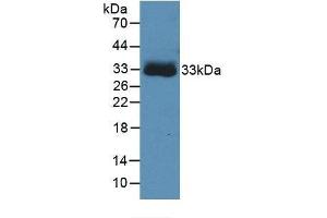 Detection of Recombinant CA4, Human using Monoclonal Antibody to Carbonic Anhydrase IV (CA4) (CA4 anticorps  (AA 19-283))