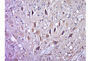 Paraformaldehyde-fixed, paraffin embedded rat brain, Antigen retrieval by boiling in sodium citrate buffer (pH6.
