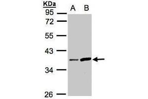 WB Image Sample(30 ug whole cell lysate) A:HeLa S3, B:Raji , 10% SDS PAGE antibody diluted at 1:1000 (PRSS8 anticorps  (Center))