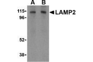 AP20058PU-N CD107b/LAMP2 antibody staining of HepG2 cell lysate by Western Blotting at (A) 1 and (B) 2 μg/ml. (LAMP2 anticorps  (C-Term))