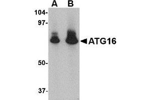 Western Blotting (WB) image for anti-ATG16 Autophagy Related 16-Like 1 (ATG16L1) (N-Term) antibody (ABIN1031245) (ATG16L1 anticorps  (N-Term))