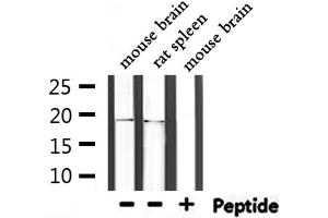 Western blot analysis of extracts from mouse brain,rat spleen, using UBE2I  Antibody.