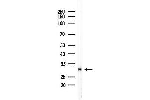 anti-RAB40C, Member RAS Oncogene Family (RAB40C) (C-Term) antibody