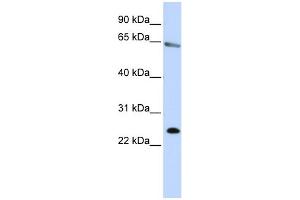 WB Suggested Anti-ZNF326 Antibody Titration:  0. (ZNF326 anticorps  (N-Term))