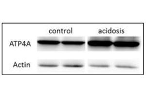 resentative western blot images of ATP4A, right panel is the quantification of the ratio of ATP4A on actin signals. (ATP4A anticorps  (AA 786-1014))