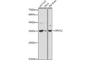 Western blot analysis of extracts of various cell lines, using SPON2 antibody (ABIN6129679, ABIN6148370, ABIN6148372 and ABIN6215647) at 1:1000 dilution. (SPON2 anticorps  (AA 27-150))