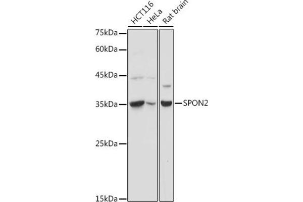 SPON2 anticorps  (AA 27-150)