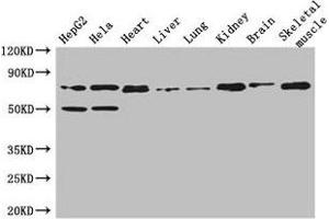 Western Blot Positive WB detected in: HepG2 whole cell lysate, Hela whole cell lysate, Mouse heart tissue, Mouse liver tissue, Mouse lung tissue, Mouse kidney tissue, Mouse brain tissue, Mouse skeletal muscle tissue All lanes: COL8A1 antibody at 3 μg/mL Secondary Goat polyclonal to rabbit IgG at 1/50000 dilution Predicted band size: 74 kDa Observed band size: 74 kDa