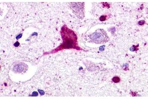 Image no. 1 for anti-G Protein-Coupled Receptor 62 (GPR62) (Cytoplasmic Domain) antibody (ABIN1048850)