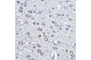 Immunohistochemistry of paraffin-embedded rat brain using NFS1 Rabbit pAb (ABIN6130225, ABIN6144595, ABIN6144597 and ABIN6222373) at dilution of 1:100 (40x lens).