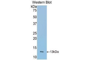 Western Blotting (WB) image for anti-Inducible T-Cell Co-Stimulator (ICOS) (AA 35-131) antibody (ABIN3207897) (ICOS anticorps  (AA 35-131))
