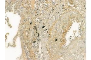 ABIN6259976 and ABIN6277005 at 1/100 staining human normal lung tissue by IHC-P.