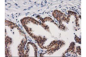 Image no. 5 for anti-Catenin (Cadherin-Associated Protein), beta 1, 88kDa (CTNNB1) antibody (ABIN1496894)