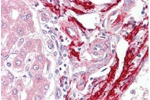 Anti-Vitronectin antibody IHC staining of human liver. (Vitronectin anticorps)