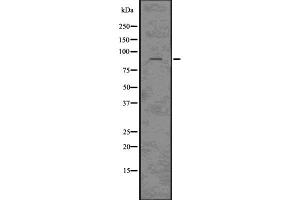 Western blot analysis of CLCN3 using HepG2 whole cell lysates