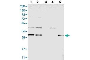 Western blot analysis of Lane 1: RT-4, Lane 2: U-251 MG, Lane 3: Human Plasma, Lane 4: Liver, Lane 5: Tonsil with TMEM17 polyclonal antibody  at 1:250-1:500 dilution.