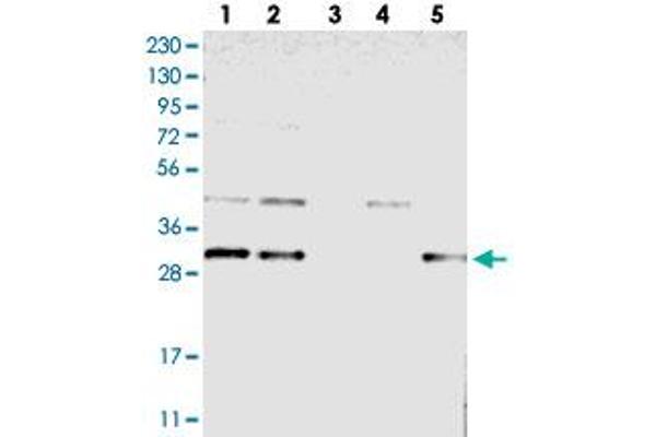 TMEM17 antibody