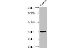 Western Blot Positive WB detected in: Rat brain tissue All lanes: Metrnl antibody at 3 μg/mL Secondary Goat polyclonal to rabbit IgG at 1/50000 dilution Predicted band size: 35, 36 kDa Observed band size: 35 kDa (METRNL anticorps  (AA 46-311))