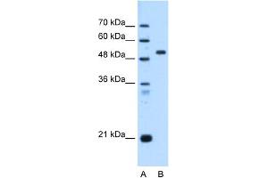 WB Suggested Anti-ST14 Antibody Titration:  0. (ST14 anticorps  (C-Term))