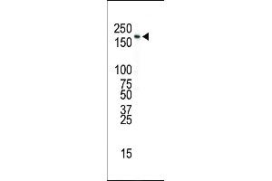 Western blot analysis of anti-INSR Pab in SK-BR-3 cell lysate