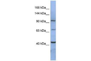RBM12 antibody used at 1 ug/ml to detect target protein. (RBM12 anticorps  (N-Term))